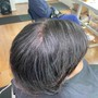 Hair Treatment (Scalp)