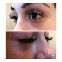 Eyelash Extension Removal