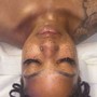 Hydra facial