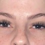 Eyelash Extension Removal