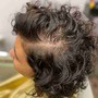 Alopecia/Hair Loss Consultation