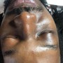 Add Dermaplaning