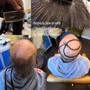 Alopecia Hair Loss Sew-in Deposit