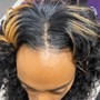 Scalp Treatment