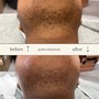 Men’s Brazilian Wax