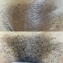 Men's Back Wax