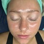 Calming facial