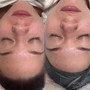 Belly Facial