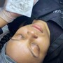 Dermaplaning Facial