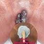 Ear Wax