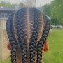 Tree Braids