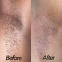 Brazilian Wax + Vajacial