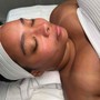 Hydra facial