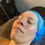 Elite High Frequency Acne Facial