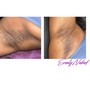 Men’s Brazilian Wax