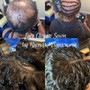 Alopecia Hair Loss Sew-in Deposit