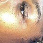 Eyelash Extension Removal