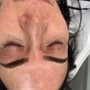 Dermaplaning Facial