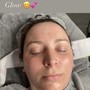 Deep pore Facial