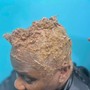 Scalp Treatment