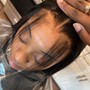 Scalp Treatment