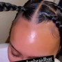 Scalp Treatment