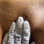 Mini facial