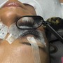 Eyelash Extension Removal