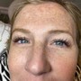 Eyelash Extension Removal