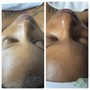 Diamond Microdermabrasion ( add on ONLY)