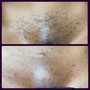 Men’s Brazilian Wax