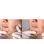 Oxygen Facial