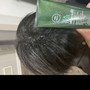 Scalp Treatment