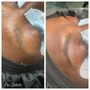 3 Back peel series