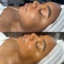 Back Facial