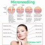 Microdermabrasion