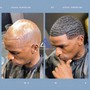 DAPPER 4-6 Month Non Surgical Cranial Prosthesis Service