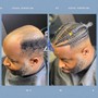 Dapper Non Surgical 4-6 Month Dread Unit