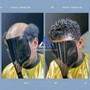 DAPPER 4-6 Month Non Surgical Cranial Prosthesis Service