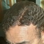 Partial Relaxer Hairline Retouch