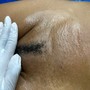 Brazilian Wax