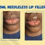 .5 Hyaluronic Needless Lip Filler