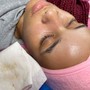 Dermaplaning Facial