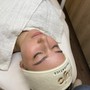 Dermaplaning Facial