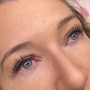 Eyelash Extension Removal