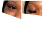 Individual Eyelash Fill-In