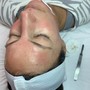 Oxygen Facial