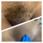 Brazilian Wax