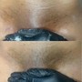 Gentlemen's Facial