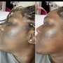 Get Glowing MICRO PEEL